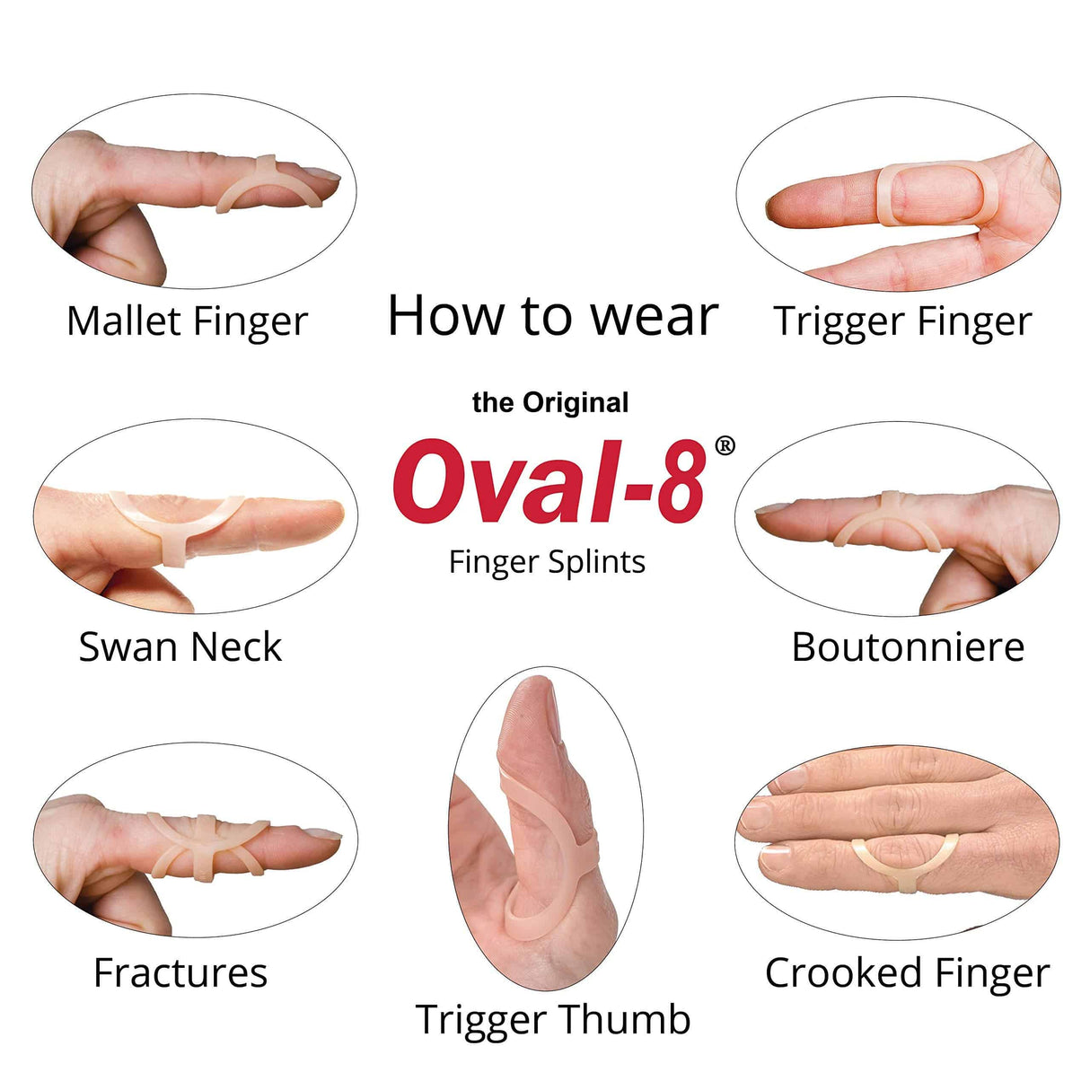 Oval-8 Finger Splint Graduated Set