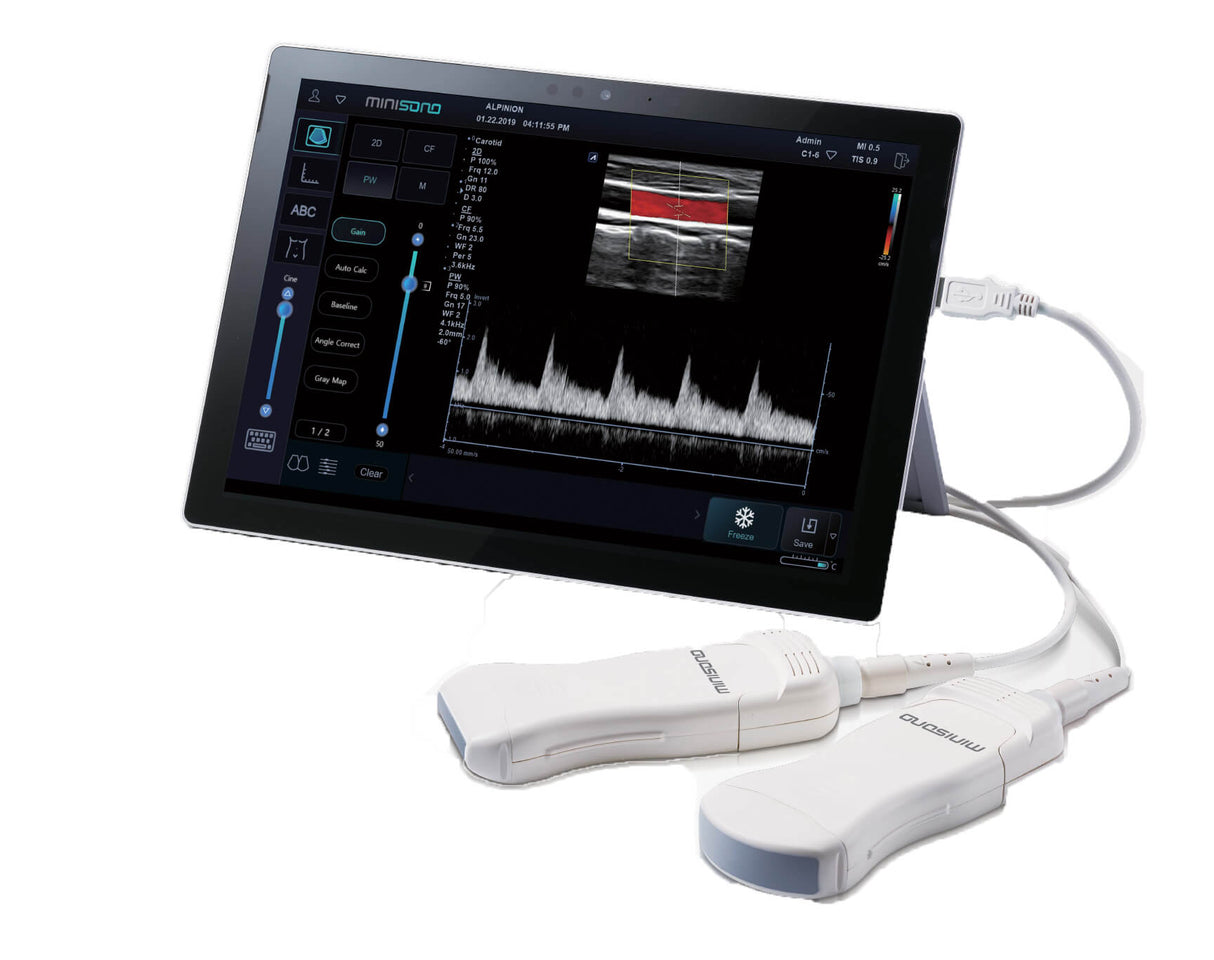 Minisono Diagnostic Ultrasound