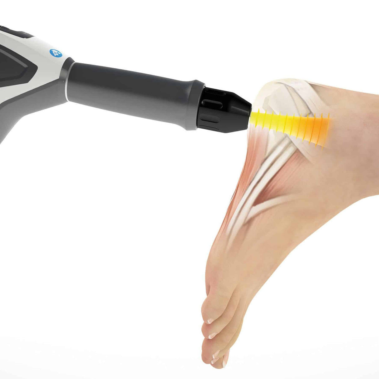 Storz Medical FALCON® Handpiece