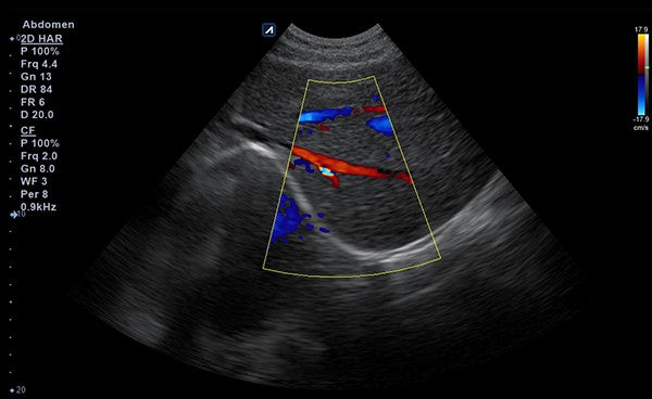 Minisono Diagnostic Ultrasound