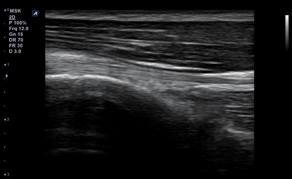 Minisono Diagnostic Ultrasound