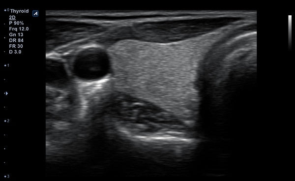 Minisono Diagnostic Ultrasound
