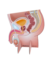 Prostate Display Diagram