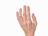 Oval-8 Finger Splints