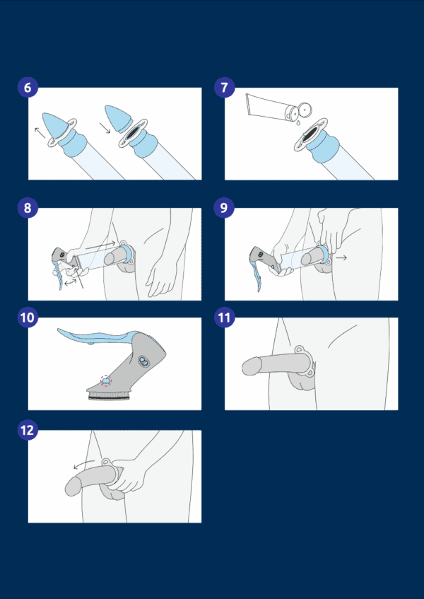 Medintim Manual Erection System