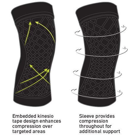 Spark Kinetic Knee Sleeve