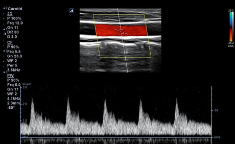 Minisono Diagnostic Ultrasound